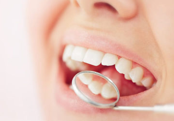 Ceramic CEREC Fillings