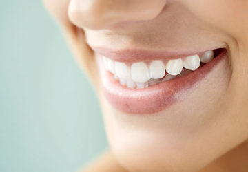 Ceramic CEREC Crowns